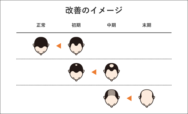 東京駅周辺のAGA治療（薄毛治療）ができるクリニックおすすめ3選！AGAの改善イメージ