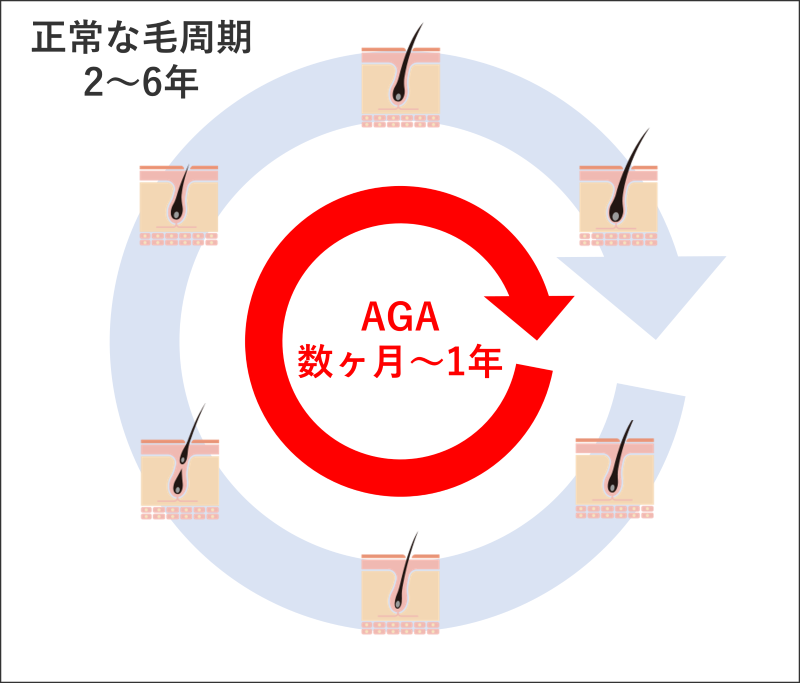 巣鴨のAGA治療（薄毛治療）ができるクリニックおすすめ3選！AGAの毛周期